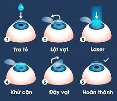 T11 2025 a Qun 23 11 3